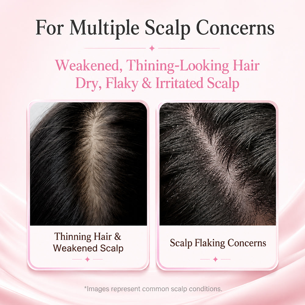 Totalglowco Botanical Scalp Renewal Serum